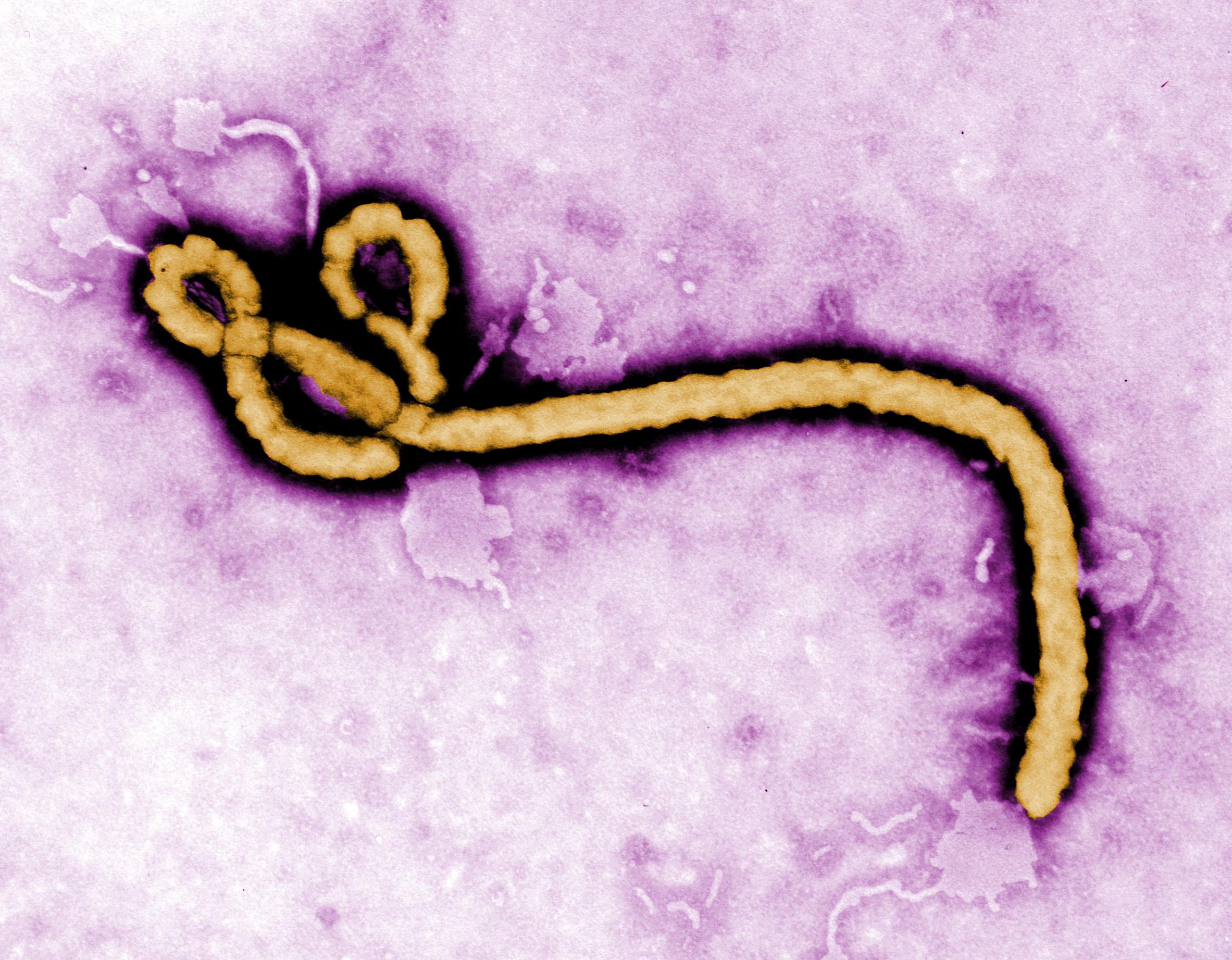 La SIMR à l’épreuve d’Ebola : surveiller pour mieux riposter